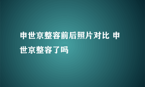 申世京整容前后照片对比 申世京整容了吗