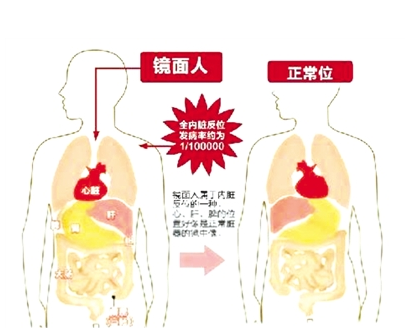 镜面人是什么？