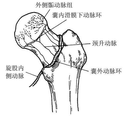 股骨颈骨折的并发症