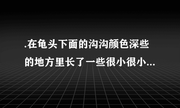 .在龟头下面的沟沟颜色深些的地方里长了一些很小很小的小痘痘似的东西.不痛不痒的