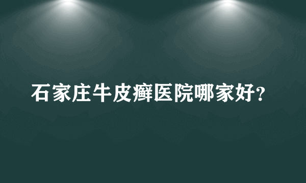 石家庄牛皮癣医院哪家好？