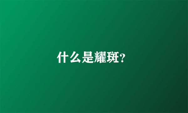 什么是耀斑？