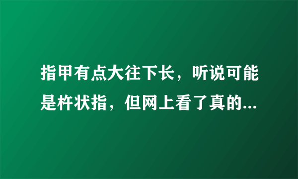 指甲有点大往下长，听说可能是杵状指，但网上看了真的杵状指图片好像又没那么夸张……好害怕啊。