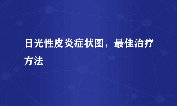 日光性皮炎症状图，最佳治疗方法