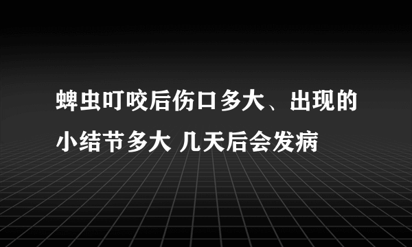 蜱虫叮咬后伤口多大、出现的小结节多大 几天后会发病