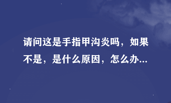 请问这是手指甲沟炎吗，如果不是，是什么原因，怎么办？有效加分