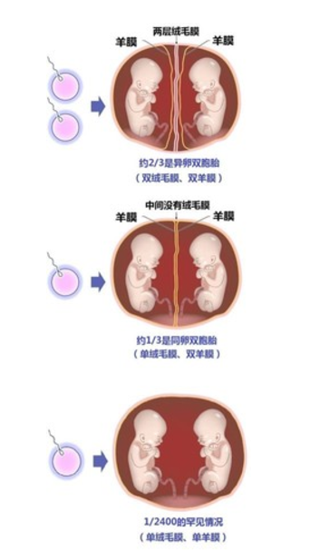 单绒双羊和双绒双羊的区别是什么