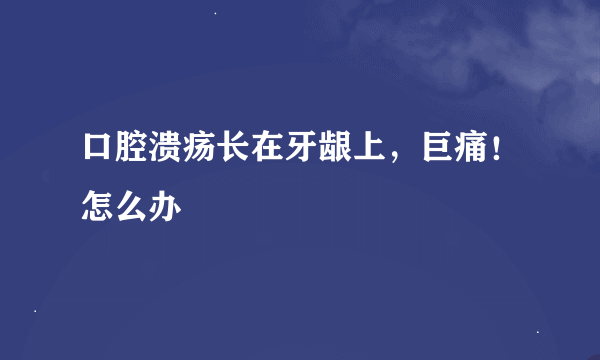 口腔溃疡长在牙龈上，巨痛！怎么办