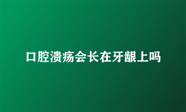 口腔溃疡会长在牙龈上吗